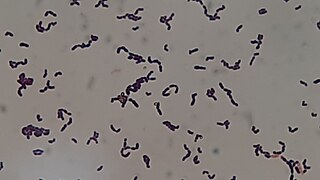 <i>Streptococcus sanguinis</i> Species of bacterium