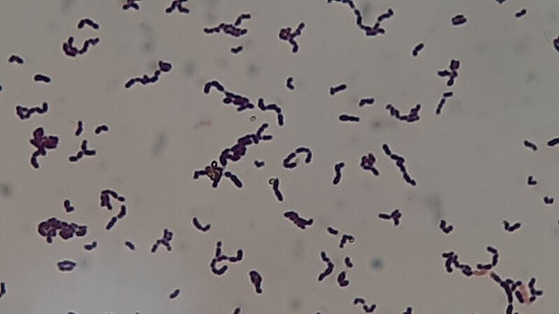 File:Streptococcus sanguinis in Gram Staining of Culture Microscopy at a Magnification of 4000X.jpg