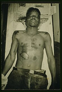 Postmortem photograph of police lynching victim Robert Hall 1943 Robert Hall postmortem photograph.jpg
