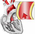Oblouk aorty je vysoce mechanicky namáhaný
