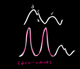 Cannon A wave Canon A Wave.png