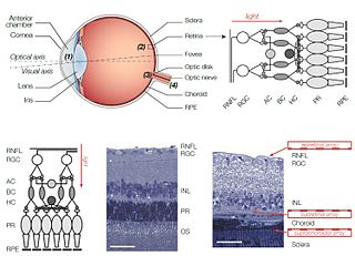 <span class="mw-page-title-main">Retinal implant</span>