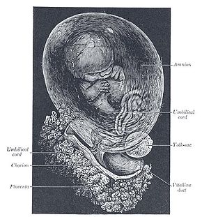 A fetus surrounded by the amniotic sac which is enclosed by fetal membranes. In PROM, these membranes rupture before labor starts. Fetus.jpg