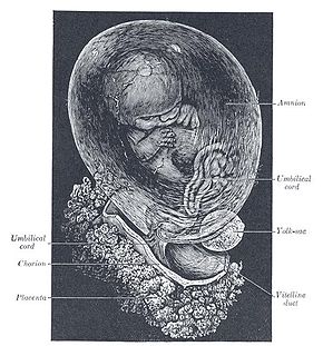 Prelabor rupture of membranes - Wikipedia