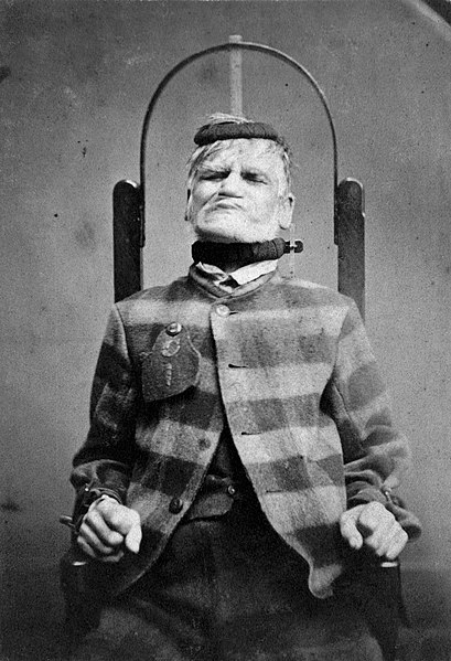 Internee in a restraint chair at the West Riding Pauper Lunatic Asylum, 1869