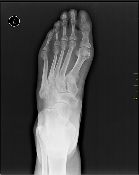 File:Medical X-Ray imaging PEP06 nevit.jpg