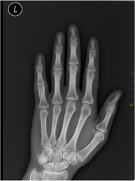 File:Medical X-Ray imaging RVZ07 nevit.jpg