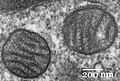 Image de cellules pulmonaires montrant des mitochondries