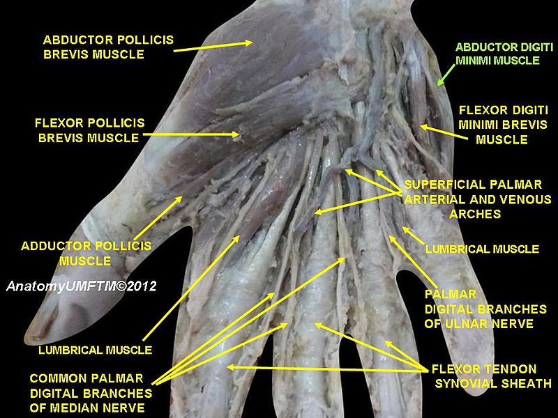 File:Slide15AAAA.JPG