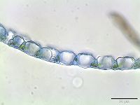 Dwarsdoorsnede van een takblad met kleine groene en grote hyaliene cellen