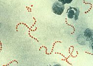 Streptococcus pyogenes.jpg