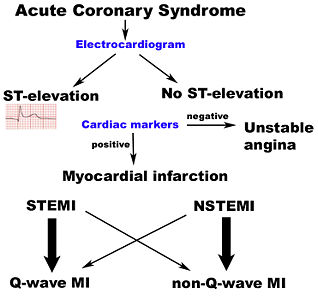 Diagnosis of acute coronary syndrome.