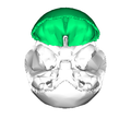 额骨内表面（顯示為綠色）。顶骨被移除。