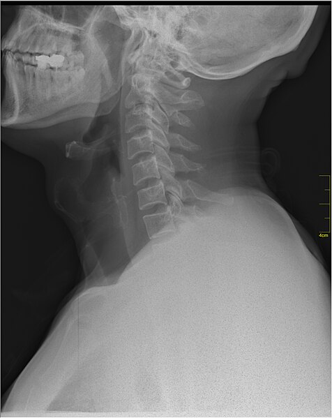 File:Medical X-Ray imaging WLR07 nevit.jpg