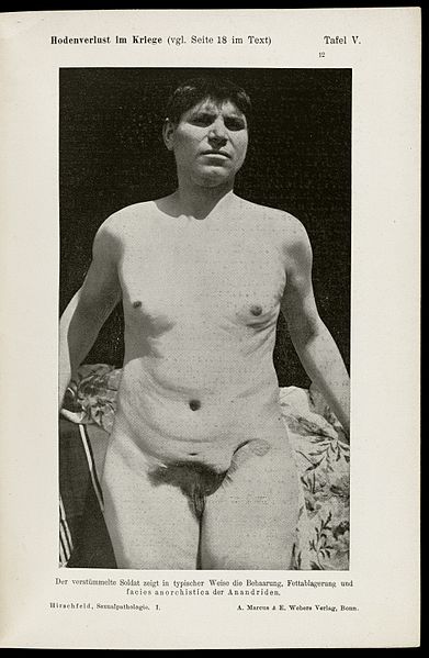 File:Photograph showing male head and torso Wellcome L0063191.jpg