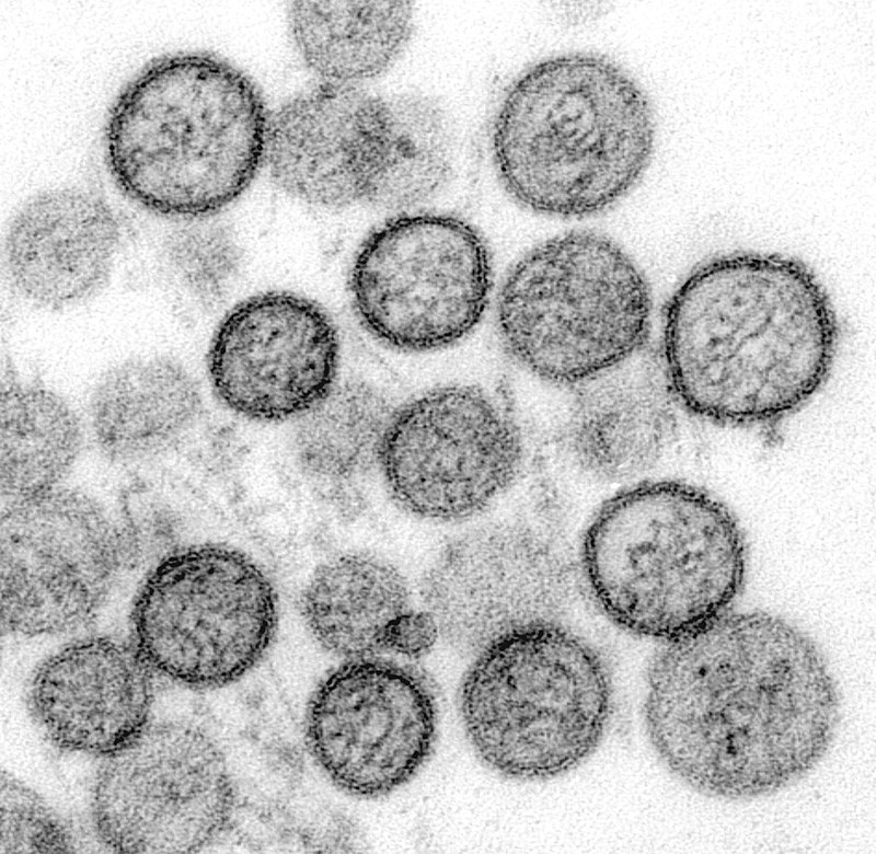 Micrografía electrónica de transmisión de Sin Nombre virus o Hantavirus. Foto: CDC/ Cynthia Goldsmith, Luanne Elliott