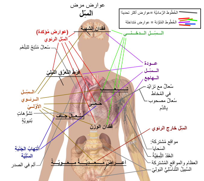 File:Tuberculosis symptoms-ar.svg