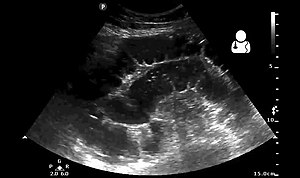 UOTW 20 - Ultrasound of the Week 3.jpg