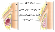 صورة مصغرة لـ متلازمة الشريان المساريقي العلوي