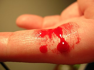 <span class="mw-page-title-main">Bleeding diathesis</span> Medical condition