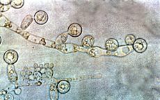 Candida albicans 2.jpg