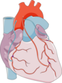 Coronary Artery Bypass Grafting 6