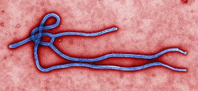 Picture showing the Ebola virus Ebola virus virion.jpg
