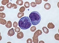 Monocytes, a type of white blood cell (Giemsa stained).jpg