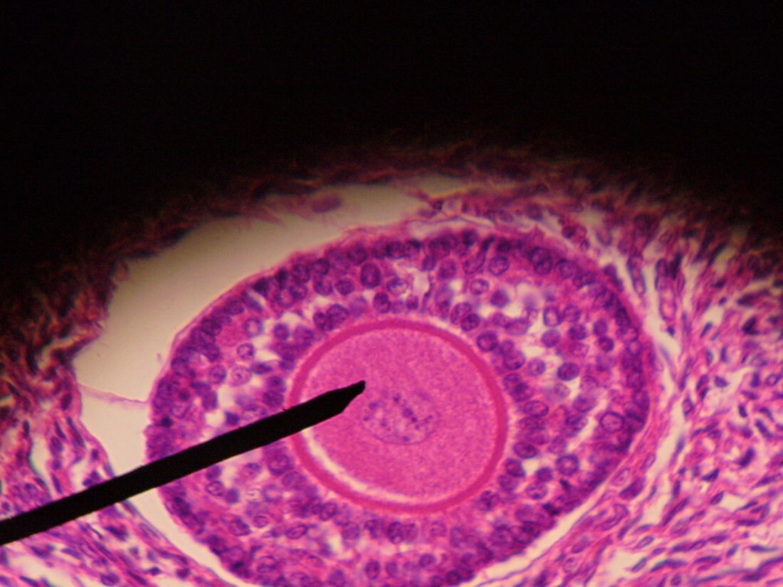 File:Primary follicle-4.JPG