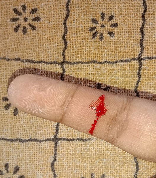 File:Red blood from human finger.jpg