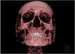 Thumbnail for Oral and maxillofacial radiology