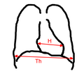 Vorschaubild für Herz-Thorax-Quotient