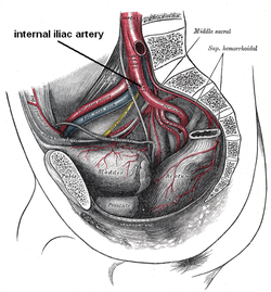 Situs arteriae iliacae internae