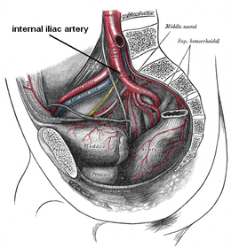 Internaliliac.png