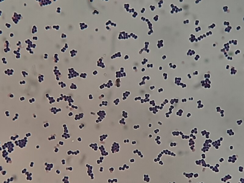 File:Leuconostoc mesenteroides Gram Staining.jpg