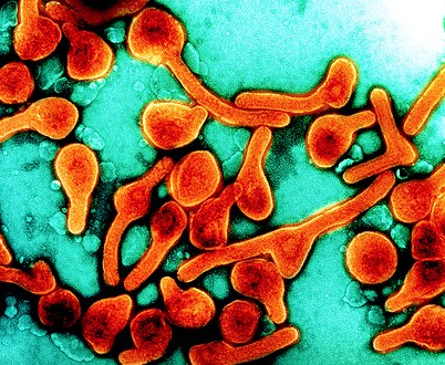 Transmission electron micrograph of Marburg virus particles harvested from infected VERO E6 cell supernatant