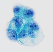 Pap stain