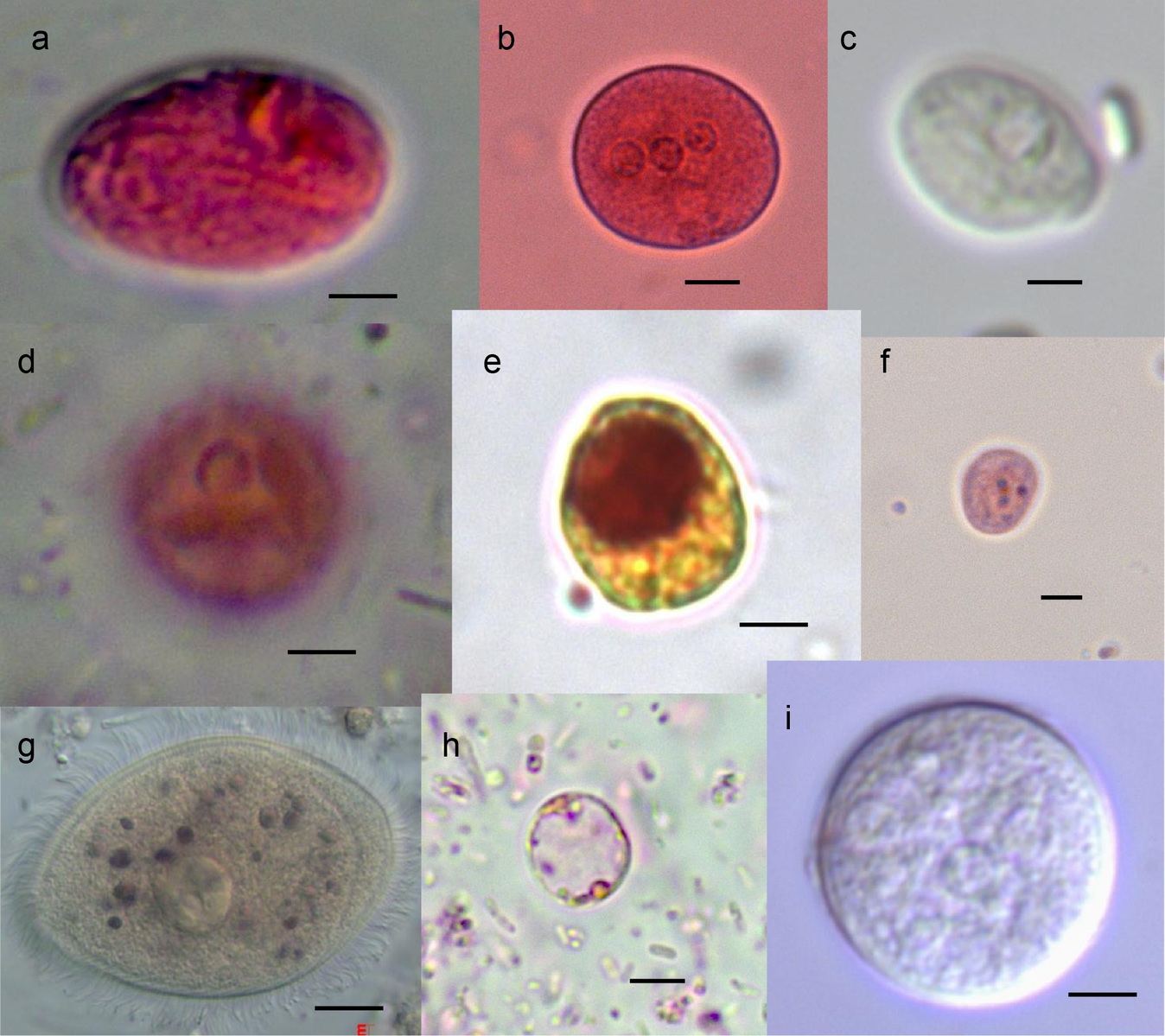 Entamoeba coli в кале. Цисты Entamoeba. Амеба Гартмана. Цисты лямблии микроскопия.