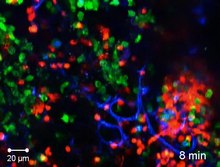 Fayl: Aspergillus-fumigatus-In-Vitro-va-yuqtirilgan o'pka-ppat.1000873.s007.ogv-ga qarshi hujayradan tashqari tuzoqlarni ishlab chiqarish