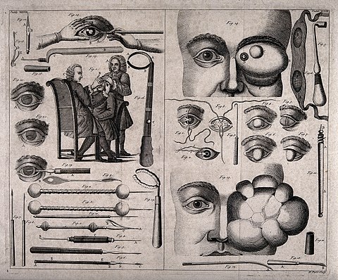 Early Ophthalmology instruments