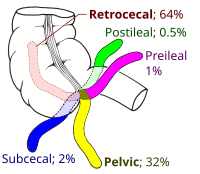 Appendix (anatomy)