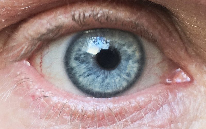 File:Blue eye 2.jpg