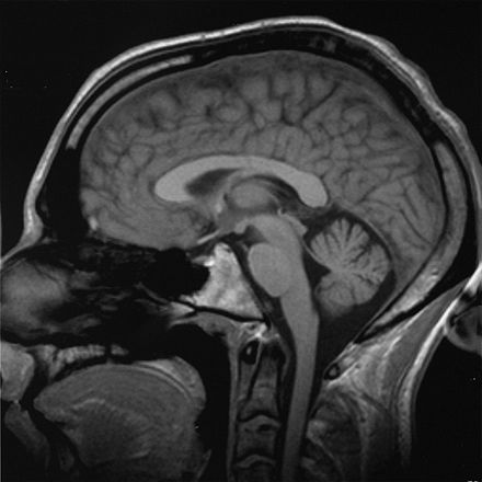 An MRI scan of a human head, an example of a biomedical engineering application of electrical engineering to diagnostic imaging. Click here to view an animated sequence of slices.