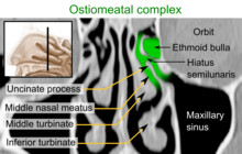 CT scan in the coronal plane, showing the ostiomeatal complex (green area) CT of the ostiomeatal complex, coronal plane, with annotations.png