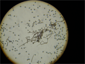 Chaetomium ascospores