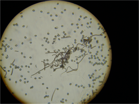 Chaetonium (Acremonium) ascospores 160X (2).png