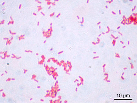 Tập_tin:Escherichia_coli_Gram.jpg