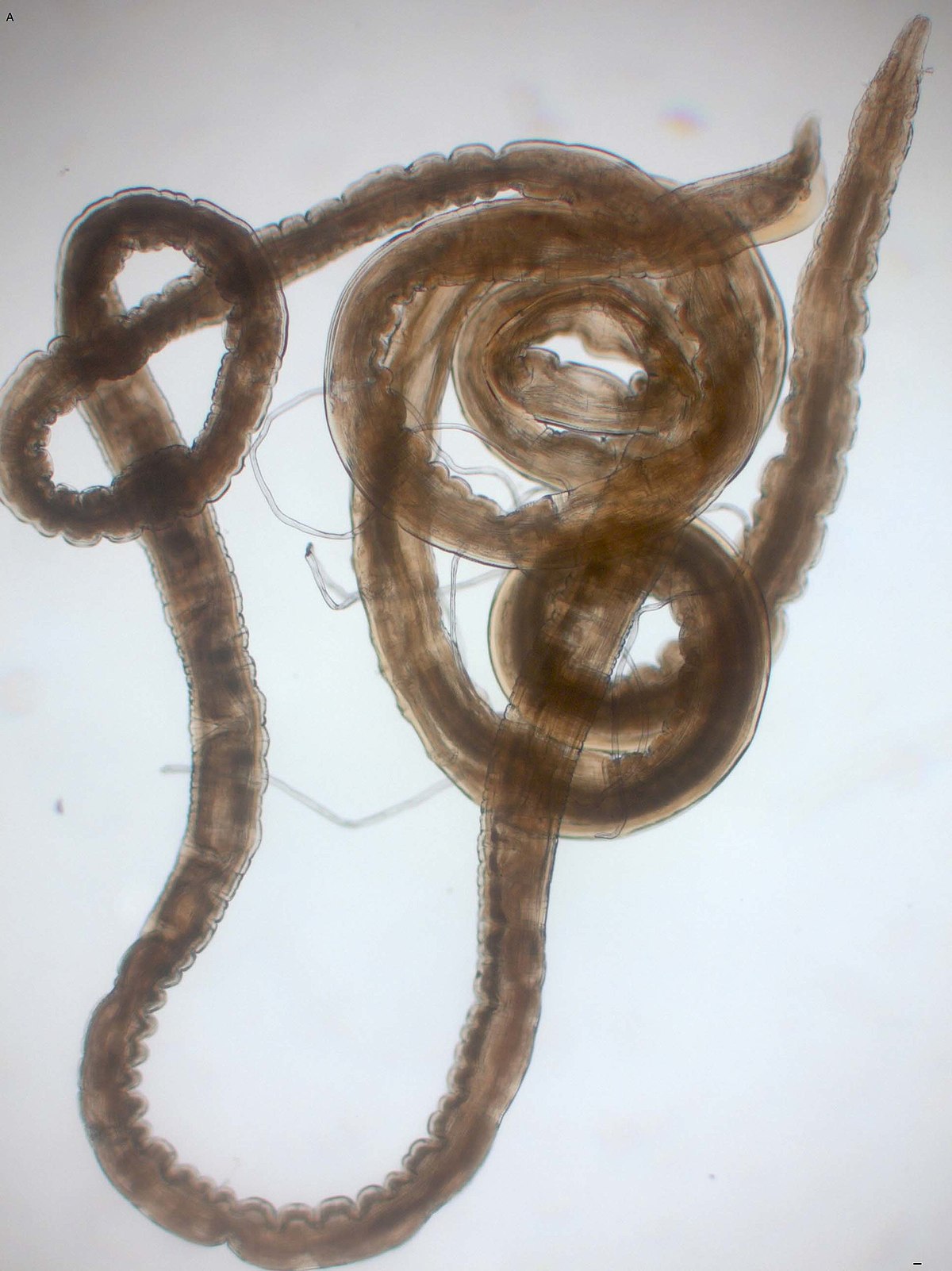 microscopic intestinal parasites in humans