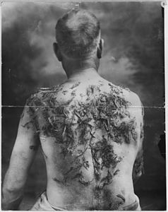 Photographie en noir et blanc représentant un homme à mi-corps, torse nu, vu de dos, avec des touffes de poils adhérant au corps.