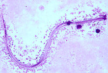 M. ozzardi microfilariae from a thick blood smear: The sample was stained with Giemsa solution for easier visualization under the microscope. M. ozzardi.jpg